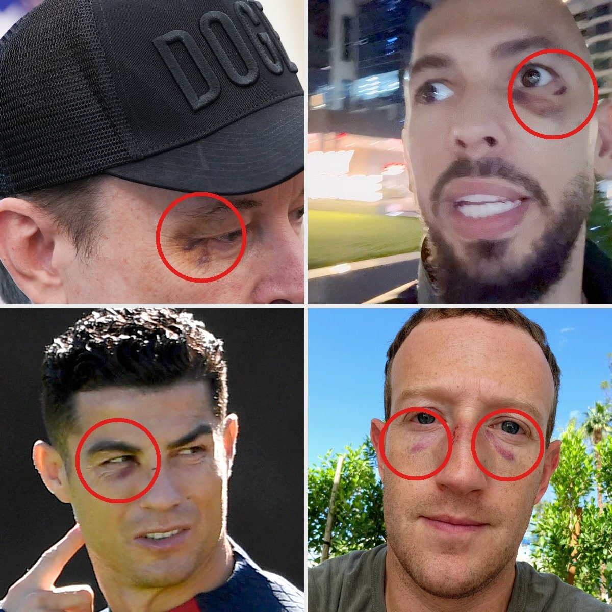kurtosxbt's tweet photo. Hey @grok, what's the hidden meaning behind this black eye?? https://t.co/wdKSE5xPsM