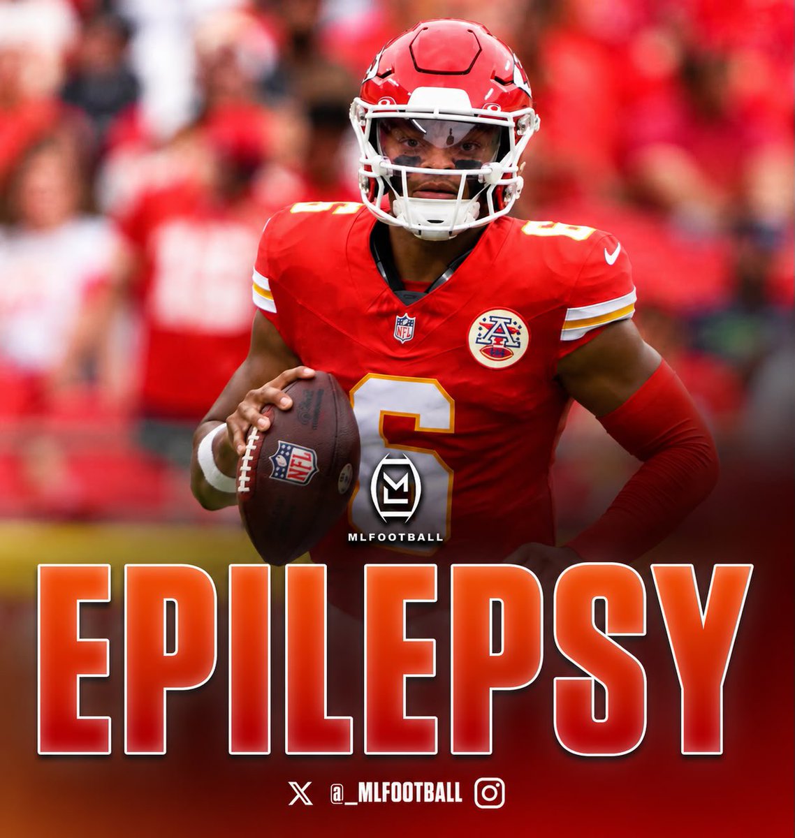 MLFootball's tweet photo. POWERFUL STORY: Kansas City #Chiefs quarterback Justin Fields had to deal with EPILEPSY growing up and learned that after having a SEIZURE during class. 

Fields was in 9th grade when he randomly lost consciousness and starting foaming from his mouth and was diagnosed later that day He says the migraines afterwards would last days at a time.

Justin now manages the disease by taking medicine wherever he goes — and has turned into a star in the league.

Inspirational for many kids battling epilepsy.

🙌🙌🙌