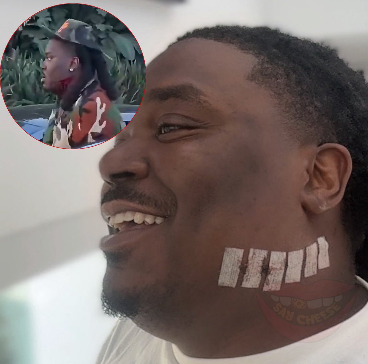 SaycheeseDGTL's tweet photo. LUCKI is all smiles while showing off the scar he was left with following the ComplexCon altercation 😳👀 https://t.co/16OW9wk1Va