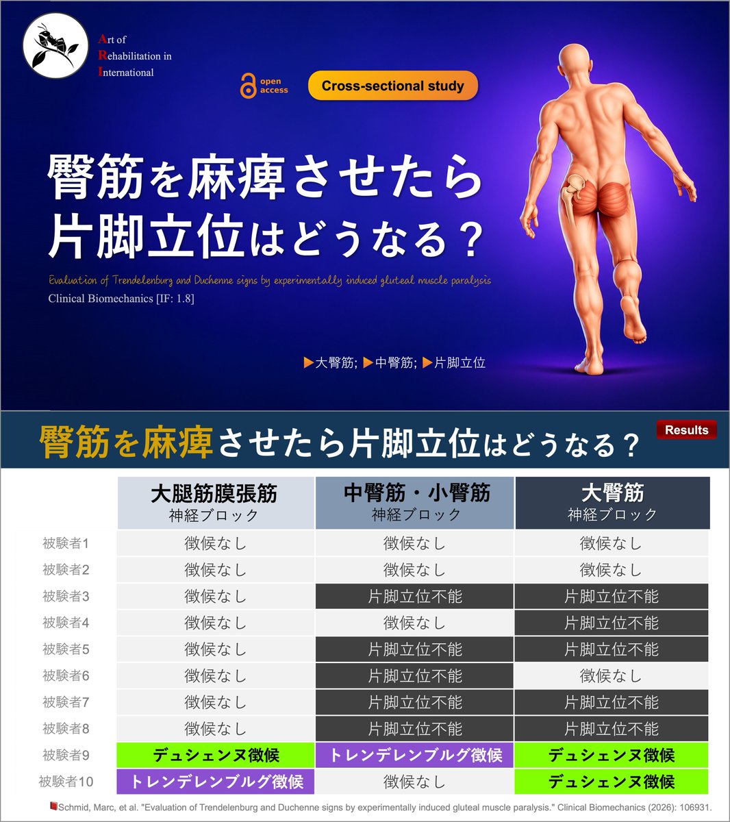 copellist's tweet photo. 📕臀筋を麻痺させたら片脚立位はどうなる？
・健常成人10名
・3種の神経ブロックで片脚立位を解析

✅大腿筋膜張筋を麻痺させた場合
・10名中8名が代償なし
・1名がデュシェンヌ徴候
・1名がトレンデレンブルグ徴候

✅中臀筋・小臀筋を麻痺させた場合
・10名中4名が代償なし
・5名が片脚立位不能
・1名がトレンデレンブルグ徴候

✅大臀筋を麻痺させた場合
・10名中3名が代償なし
・5名が片脚立位不能
・2名がデュシェンヌ徴候

この実験からの示唆↓
1️⃣大臀筋も股関節外転への貢献が大きい
2️⃣中臀筋・小臀筋 vs. 大臀筋の筋力低下では跛行の種類が変わる可能性

とても興味深い実験結果です😲