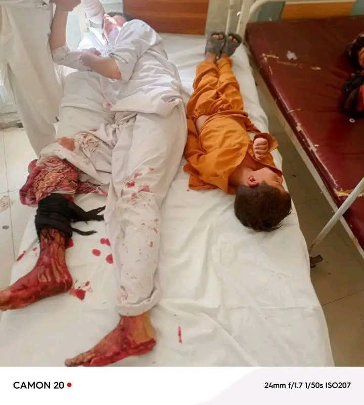soldierspeaks's tweet photo. In Nauna village, in Mirali Tehsil, North Waziristan, Khyber Pakhtunkhwa, the Pakistani army dropped a bomb from a quadcopter drone, severely injuring eight innocent children.

The injured children have been shifted to Mirali Hospital for treatment. Various blood groups are urgently needed. An urgent appeal is made to all youth, especially volunteer blood donors, to reach Mirali Hospital immediately and help save these innocent children’s lives.

This is the Hard State of the psychopath Asim 'Yazid' Munir