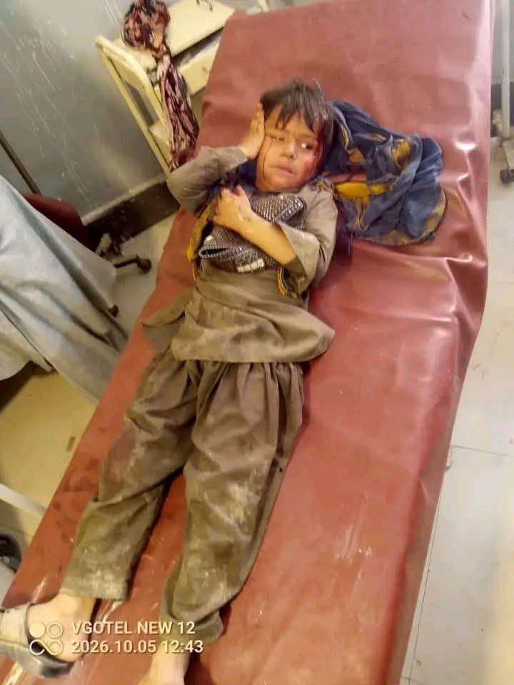 soldierspeaks's tweet photo. In Nauna village, in Mirali Tehsil, North Waziristan, Khyber Pakhtunkhwa, the Pakistani army dropped a bomb from a quadcopter drone, severely injuring eight innocent children.

The injured children have been shifted to Mirali Hospital for treatment. Various blood groups are urgently needed. An urgent appeal is made to all youth, especially volunteer blood donors, to reach Mirali Hospital immediately and help save these innocent children’s lives.

This is the Hard State of the psychopath Asim 'Yazid' Munir