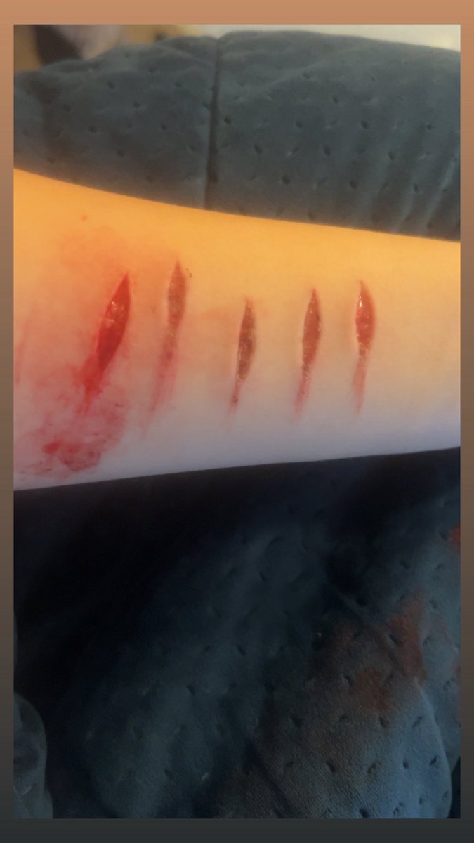 anglichrrt's tweet photo. Wish I could go deeper 🔪 https://t.co/KaDV7zDYKn