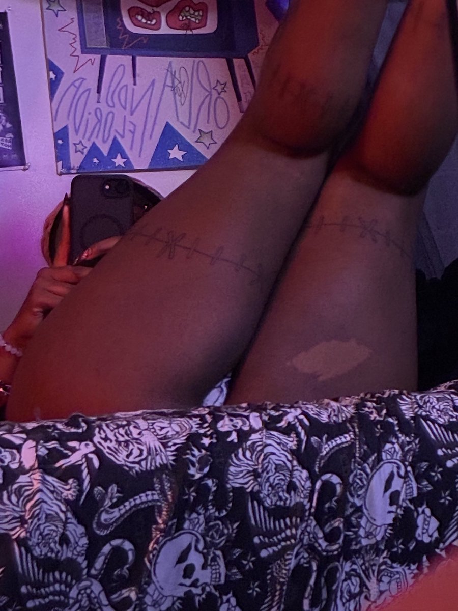 v4mpjaez's tweet photo. showin off my birthmark

#nsfwtwt #nsfwtwtً #gooner https://t.co/9E7JRfCT6z