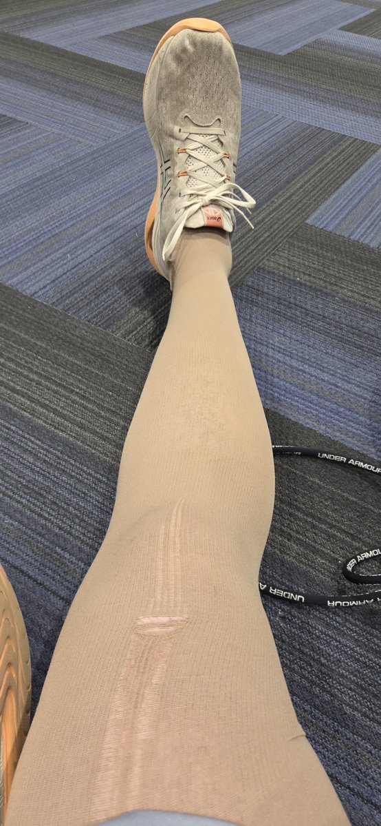 HawtornVRabot's tweet photo. The worst part about #bloodclots and #bloodthinners is I can't get an #injection to help my #chronicpain since it could cause #internalbleeding . https://t.co/SeC1znl2a5