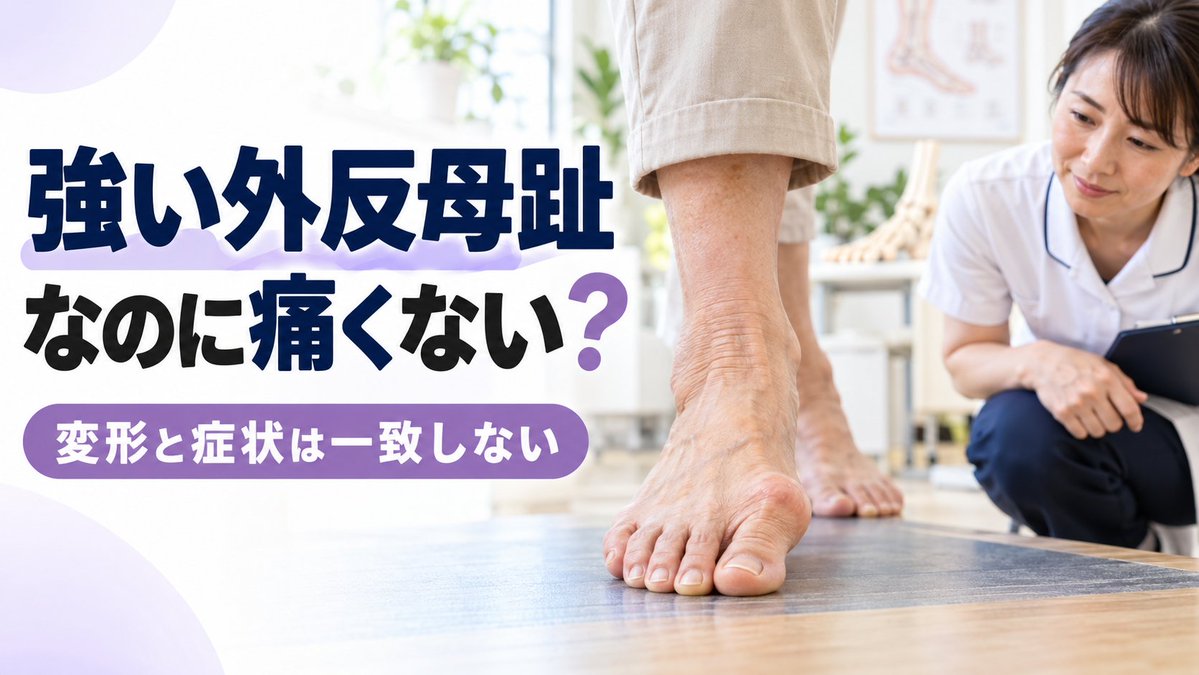 unahone's tweet photo. 強い外反母趾なのに痛くないのはなぜ？
https://t.co/2FSPuE08NU https://t.co/gTU3sC6jBg
