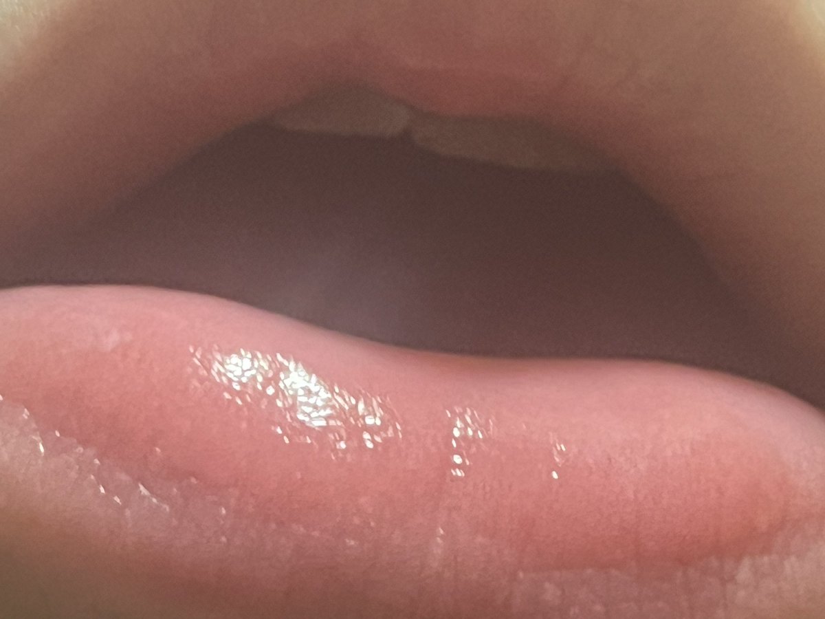 gothicperv's tweet photo. You never would’ve thought you’d be as big as a taste bud. But here you are. Suffocating on my breath and I can’t even see you. https://t.co/oDj0HdpG9z