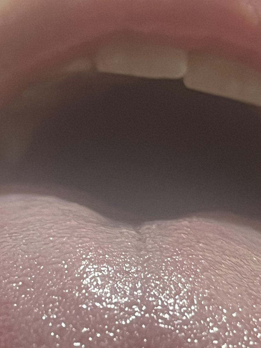 gothicperv's tweet photo. You never would’ve thought you’d be as big as a taste bud. But here you are. Suffocating on my breath and I can’t even see you. https://t.co/oDj0HdpG9z