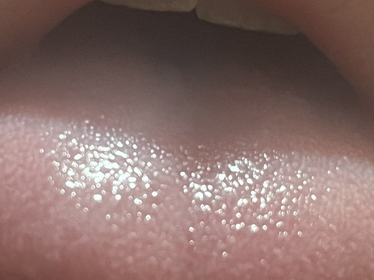 gothicperv's tweet photo. You never would’ve thought you’d be as big as a taste bud. But here you are. Suffocating on my breath and I can’t even see you. https://t.co/oDj0HdpG9z