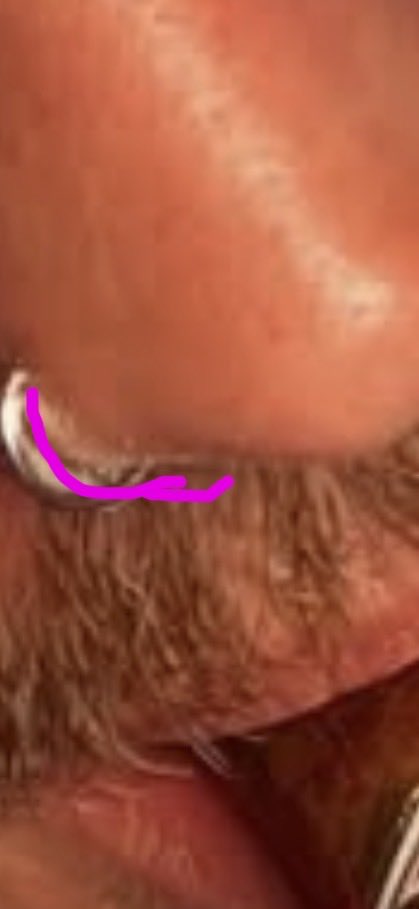 kmhnw6's tweet photo. @C63amg___ @xxabice não, não tem o mesmo reflexo do piercing 
e não, não tá só na lateral
inclusive a tua foto só provou o que a guria disse pq na foto q tu mandou aqui o nariz dele tá impecável, acho melhor vc parar de cheirar po tbm e quando tu estiver sóbrio pra debater a gente conversa https://t.co/avy3rvDiFA