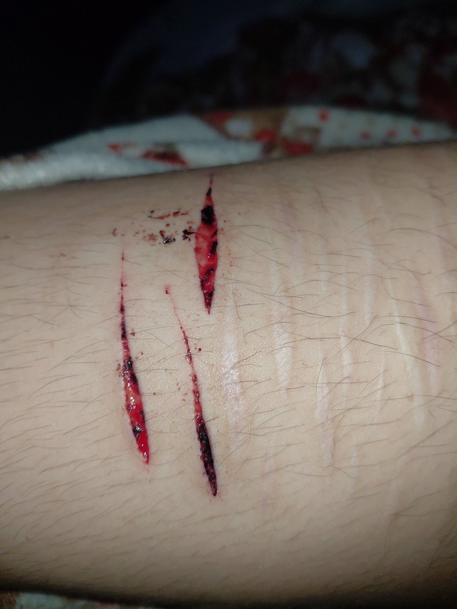 bloodyyspecter's tweet photo. ES FAKE BLOOD FAKE MAKEUP FX https://t.co/454wbc3Bjm