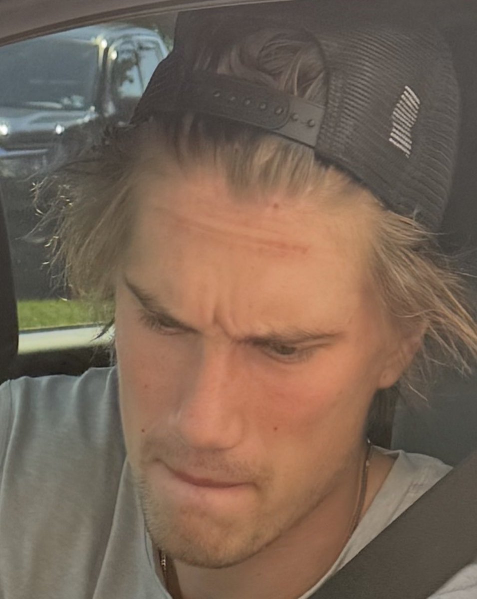 genosidtanger's tweet photo. this photo of i took of soda is so endearing to me. https://t.co/wKbryPZ8oz
