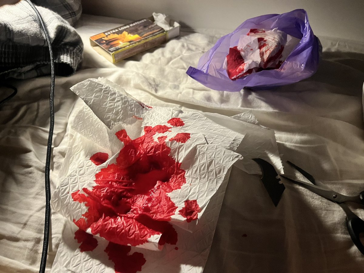 puppifiedcorpse's tweet photo. ai blood ai every ai ai ai but also oh mu god i replaced the tissue i used to try defend my sheets (failed) so many times https://t.co/dsbMdEp232