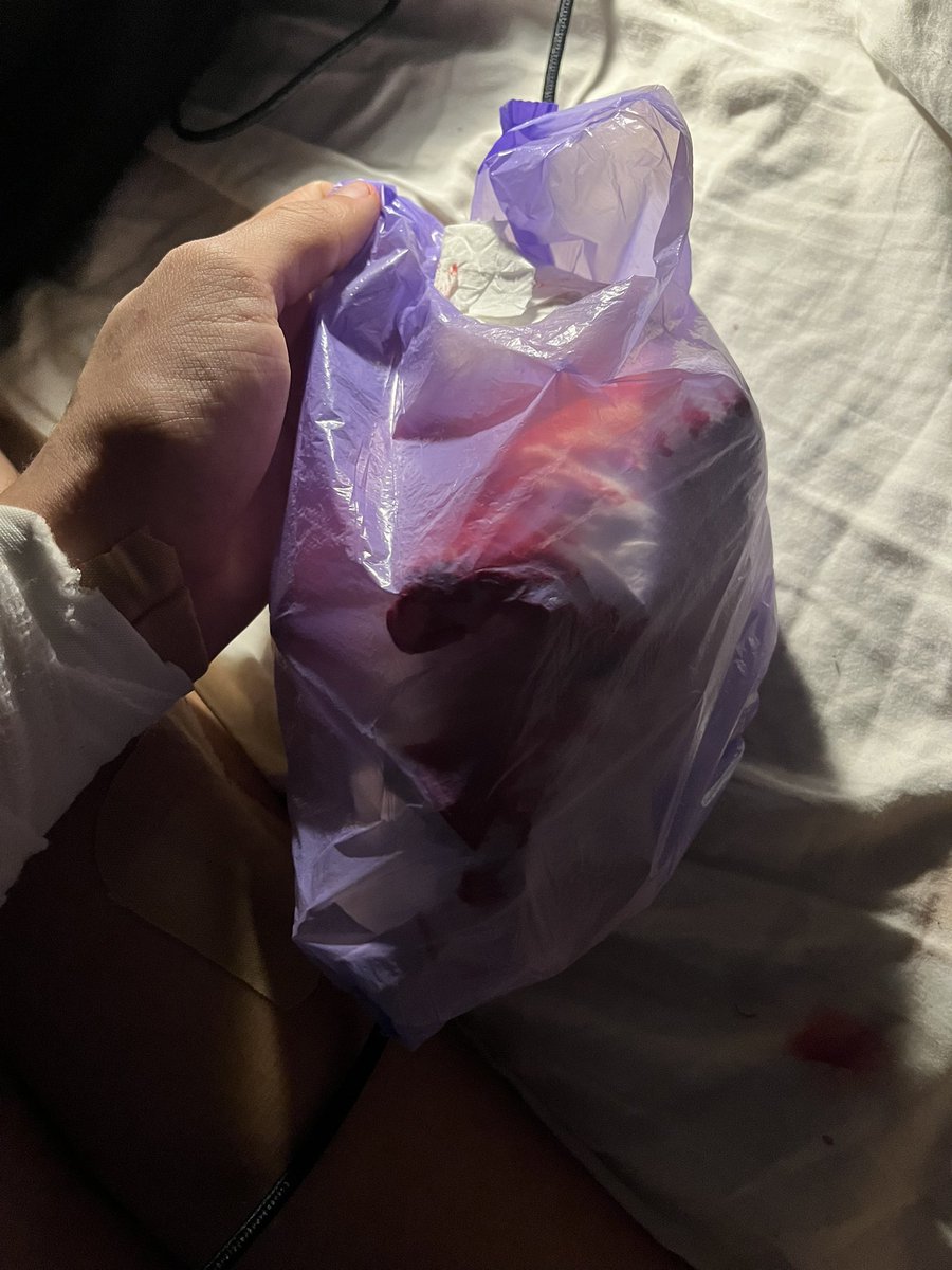 puppifiedcorpse's tweet photo. ai blood ai every ai ai ai but also oh mu god i replaced the tissue i used to try defend my sheets (failed) so many times https://t.co/dsbMdEp232