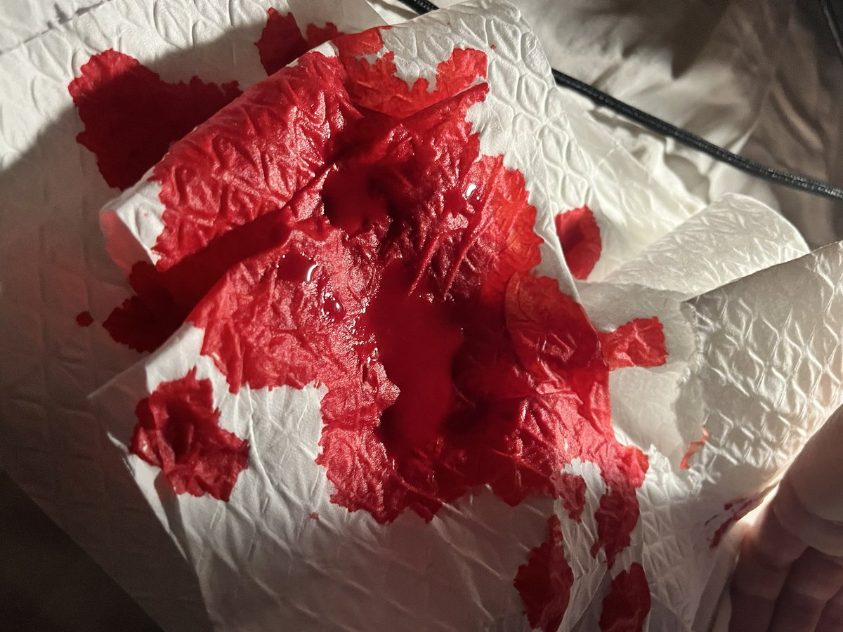 puppifiedcorpse's tweet photo. ai blood ai every ai ai ai but also oh mu god i replaced the tissue i used to try defend my sheets (failed) so many times https://t.co/dsbMdEp232