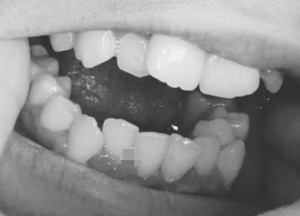 loserlesbianb's tweet photo. do we fw crooked teeth👀 https://t.co/U1t68ltj6e