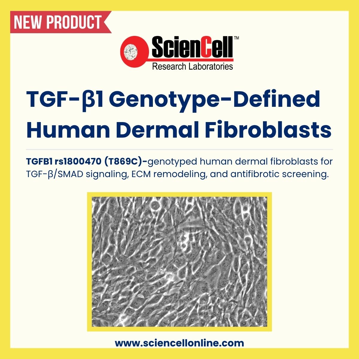 sciencell's tweet photo. 🧬 New: TGFB1 rs1800470 (T869C)-genotyped human dermal fibroblasts for TGF-β/SMAD signaling, ECM remodeling, antifibrotic screening &amp; pharmacogenomics. 

Contact info@sciencellonline.com for donor/lot availability.#TGFB1 #Fibroblasts https://t.co/IIievcroaa