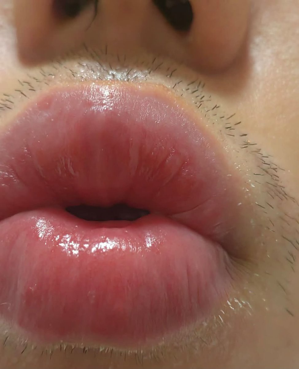 nadaeladela's tweet photo. iseng pakaiin PAKSU lipcare rekomendasi mbak GUARDIAN, awalnya mikir bakal gk ngaruh eeh setelah 2 minggu bibir GELAPNYA  yang suka ngerokok auto ngepink dan plumpy, sampe ngomel2 sendiri katanya "malu kumisan tapi bibir kyk cewek" 😭😂￼ https://t.co/h0UvCArgdv