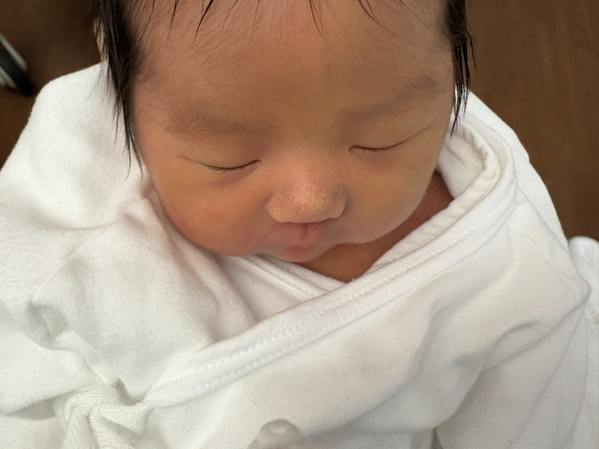 jillaaa_sky2's tweet photo. 全く一致過ぎてすごい
お腹の上から機械当てただけなのに中身こんな鮮明に見えるのどうなってるの
ほっぺもエコー通りぷりんぷりんだった笑
みんなからほっぺ可愛い言われるw https://t.co/18GOwgQu47