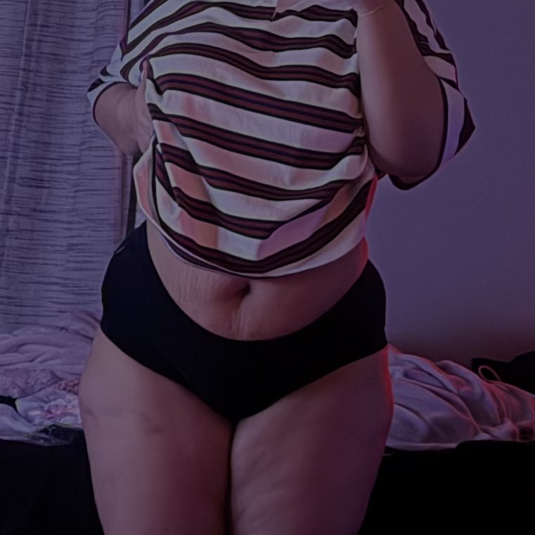 lliljaz's tweet photo. stretch marks and cellulite🥲 https://t.co/LxMDVGZzX3