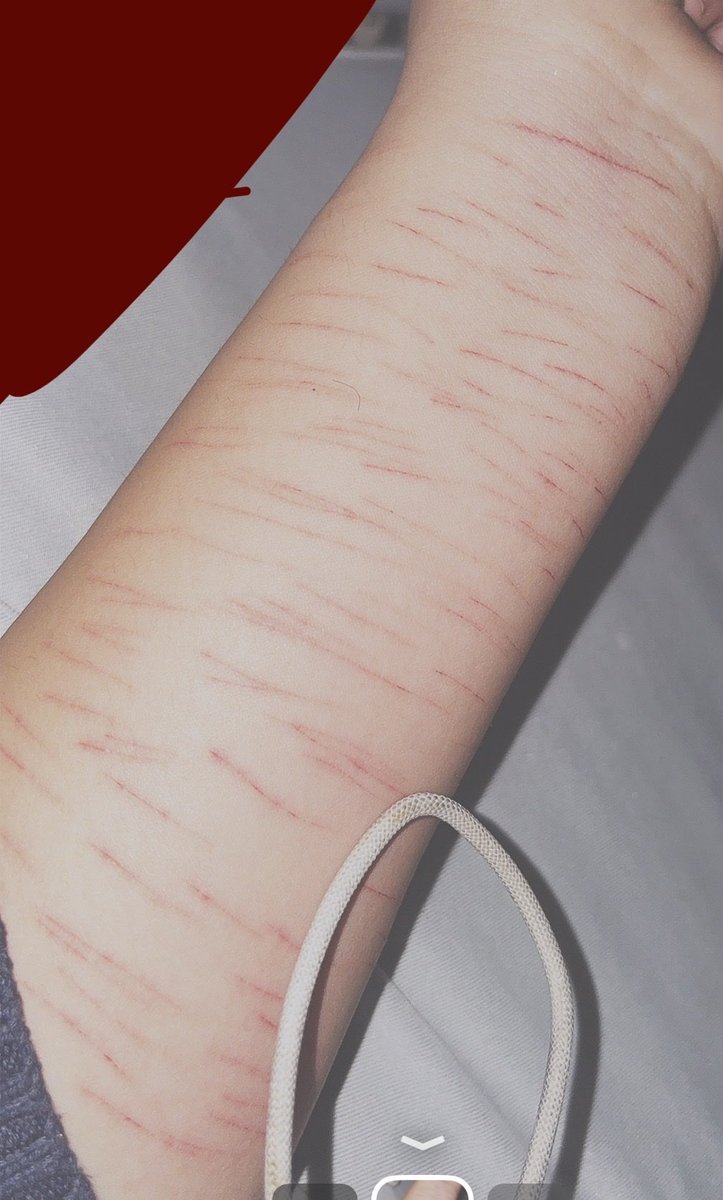 appledeerbabe's tweet photo. ˚.⋆꒰১ ໒꒱⋆.˚ #sfx #fake #makeup FAKE BODY https://t.co/tCOBDvs2ql