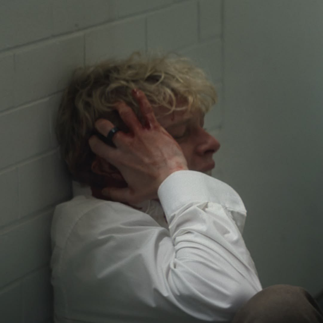 naimbug_'s tweet photo. Pretty boy, natural blood stained blond https://t.co/TkKW9bfw8X