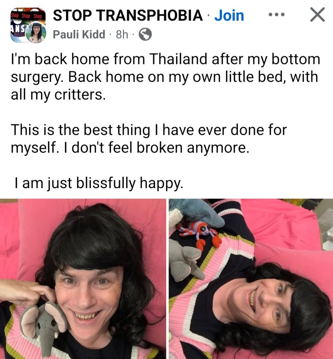 ManySuchCases's tweet photo. Another mentally unwell man had his genitals surgically inverted in a delusional attempt to live out his autogynephilia. Many such cases. https://t.co/895Q0WiEsT