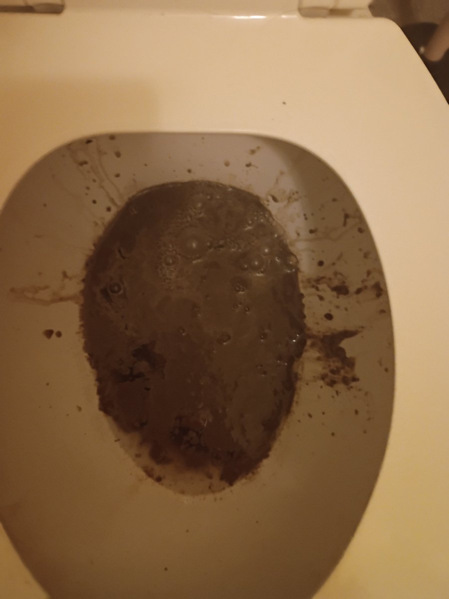 Melrah_harlem's tweet photo. Pictures of my poop,pee and diarrhea before I have awful stomach issues https://t.co/lI1hb8F3Xx