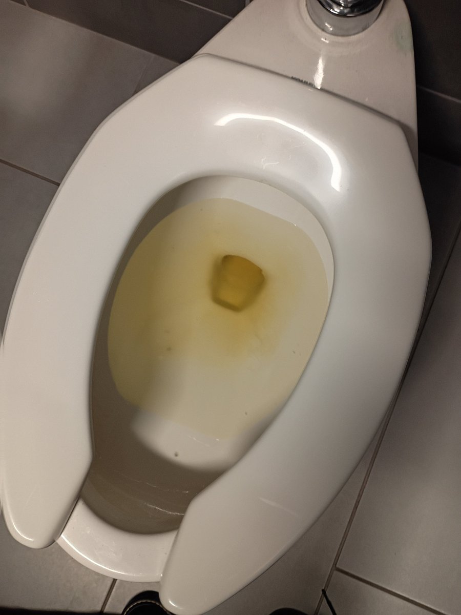 Melrah_harlem's tweet photo. Pictures of my poop,pee and diarrhea before I have awful stomach issues https://t.co/lI1hb8F3Xx