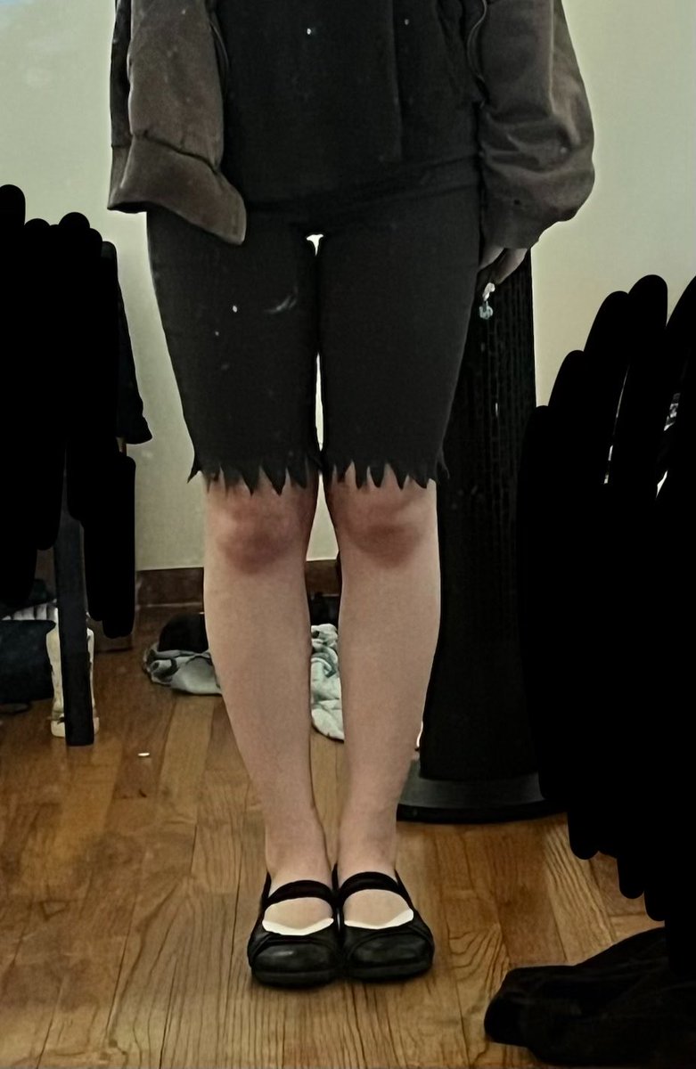 adreenarexic's tweet photo. nobody is probably gonna see this but this is an 18lb difference is this that noticeable? it doesn't look like that big of a difference to me ugh🤦‍♀️

(srry abt the over excessive censoring i can't take any chances) https://t.co/D9cXwsRfMj