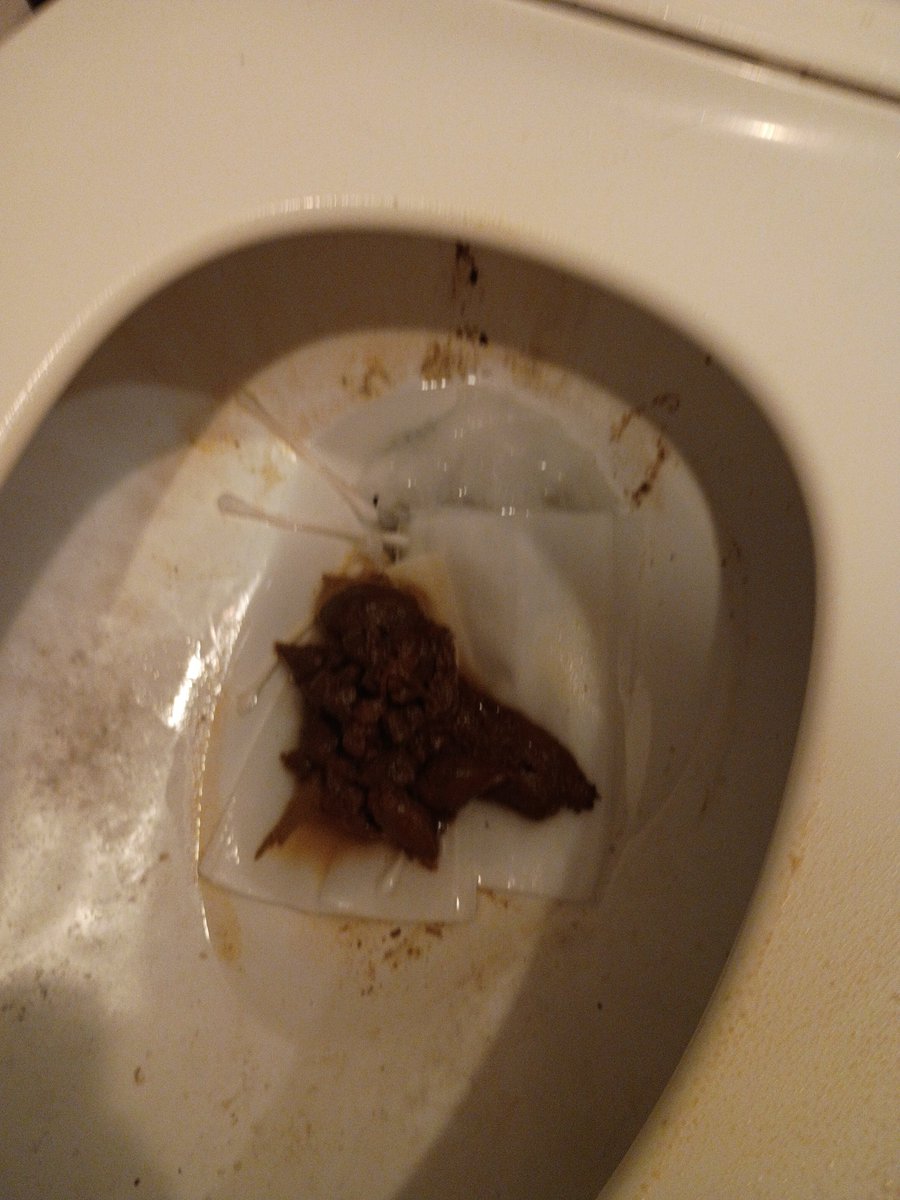 Melrah_harlem's tweet photo. Pictures of my poop,pee and diarrhea before I have awful stomach issues https://t.co/lI1hb8F3Xx