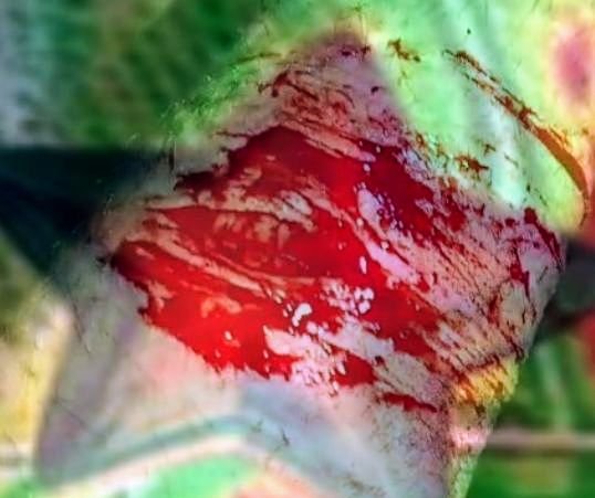 Thewyrexic's tweet photo. SFX Halloween makeup all Fake and very realistic ☆｡⁠.ﾟ⁠◑ #shtwtt #ouchietwt recuerdo lo asustado k estaba en ese entonces :3 https://t.co/IXK9hkWGwC