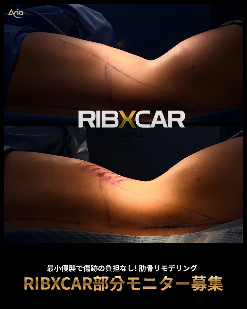 _Ariajapan's tweet photo. ARIA単独イベント【#リブスカー】📢
✨ 部分モニター大募集 ✨

今なら30% OFF!!【800万ウォン】
✈️ さらに【11月までの手術限定】往復航空券特典付き！

韓国初導入✨アイルミ整形外科 チェ・サンギュ副院長だからこそ可能な最新技術 #リブスカー！

リブスカーは、肋骨を切除することなく内側にセットバック固定することで、骨格レベルでキュッと引き締まった理想のくびれを作る最新のボディライン施術です🌿

💡 こんな方におすすめ
🔹 脂肪吸引だけでは変化に満足できなかった方
🔹 骨格からしっかり細いくびれを作りたい方
🔹 傷跡や負担を抑えつつ、確実に変化を実感したい方

気になる方は、まずお気軽に公式LINEまでご相談ください🌸

📨 公式LINEでのご相談・ご予約はこちら👇
https://t.co/dpqcL8hGQK

#リブスカー #肋骨セットバック #ウエスト整形 #くびれ作り #骨格ボディメイク #韓国整形 #通訳同行 #渡韓整形 #韓国美容外科 #ARIA