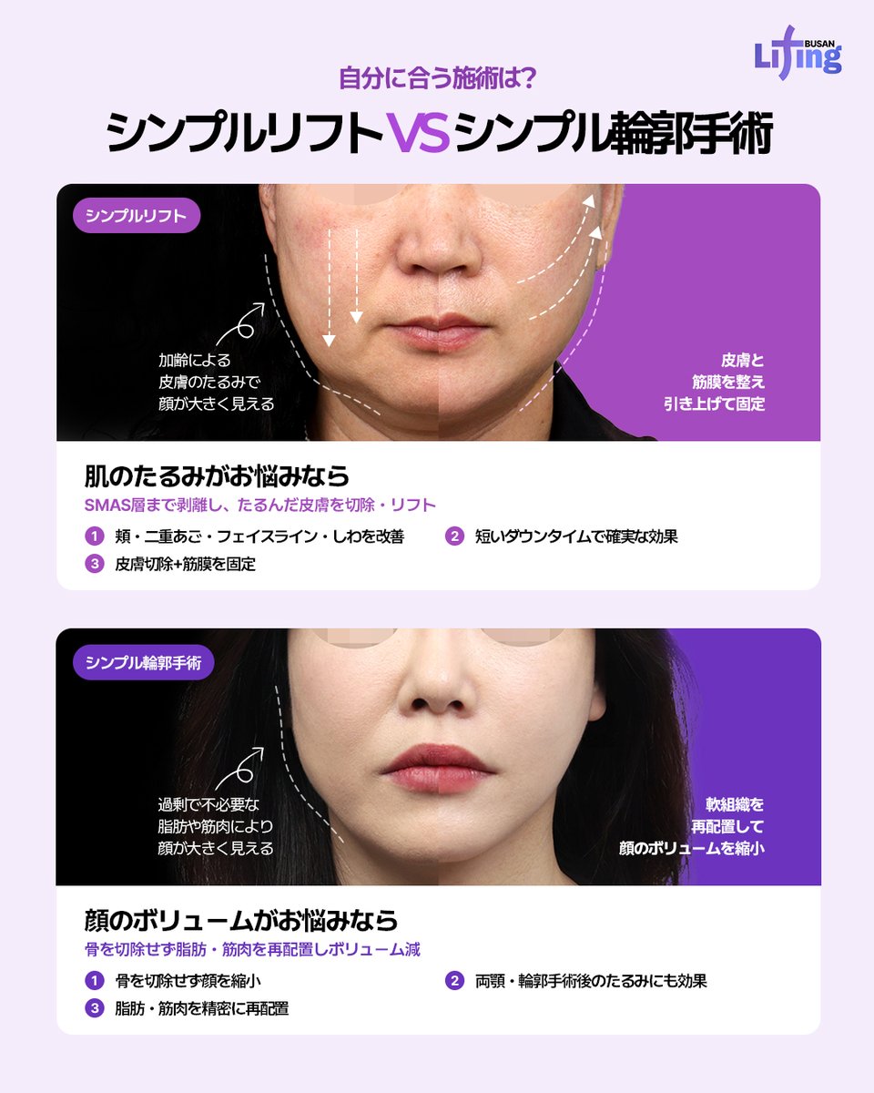liting_japan's tweet photo. 📌リティング釜山

✨シンプルリフト VS シンプル輪郭術✨

「たるみ」が気になる？
「顔のボリューム」が気になる？

🔹シンプルリフト
たるみを整えて、すっきりリフトアップ✨

🔹シンプル輪郭術
脂肪・筋肉を整えて、すっきりフェイスラインへ✨

📢詳細はプロフィールへ👆
お気軽にご相談ください💨

#リフトアップ #韓国美容