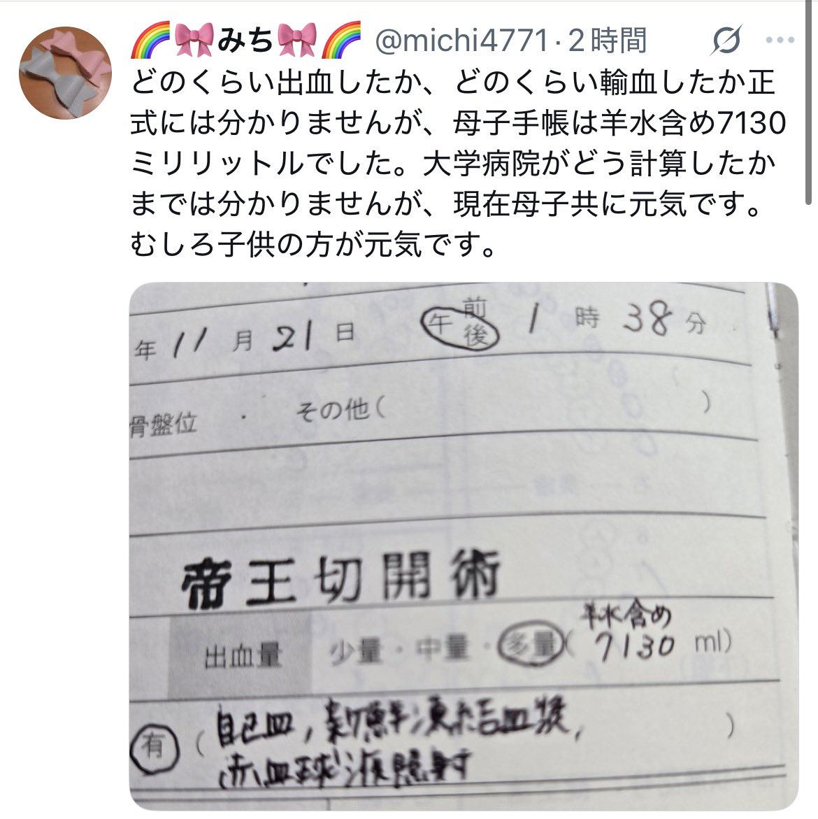mo_ti02's tweet photo. 「羊水含め」らしいですよ

実際の情報を意図的に隠して発信するから、信頼って失っていくんですよ

話を盛るのも嘘を混ぜるのもそう

こういう姑息なことをするから、「命懸け」って言葉が軽視されていく

オオカミ少年の話知らないの？ https://t.co/3fLDP6HadK