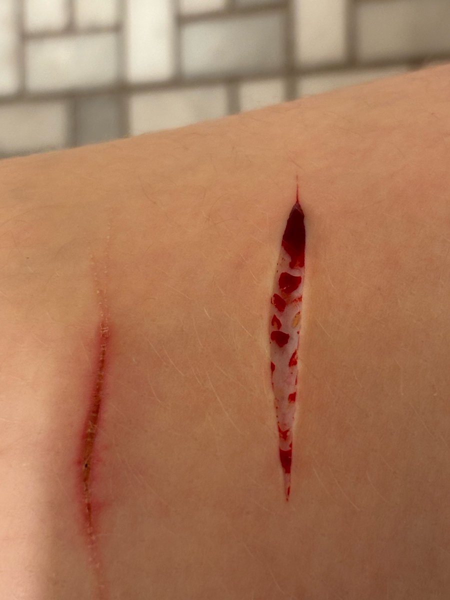 silIysakuraa's tweet photo. Decided to cut today and accidentally hit baby beans :)
I’ve never wanted to go deeper than a styro but it’s so pretty (˶ᵔ ᵕ ᵔ˶)
ALL FAKE SFX I DO NOT CONDONE THIS BEHAVIOR 
shtwt https://t.co/sBgxSlA6ey