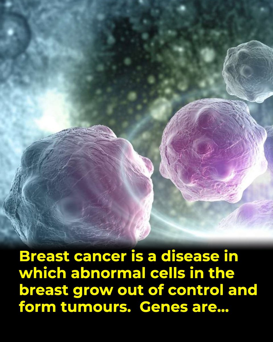 research_front's tweet photo. Most breast cancer is not genetic, according to international studies. But is that true for Jamaica? Most Jamaican patients show signs of a genetic link.

Read my full essay. Link in my bio. https://t.co/acojwSwyNf
