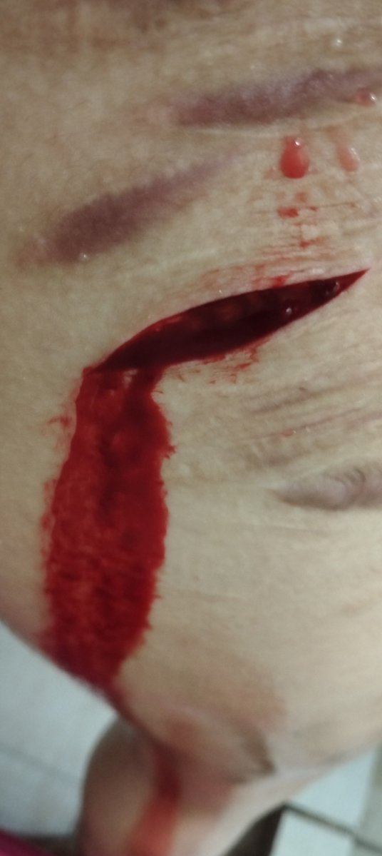Necronagix's tweet photo. Alaberga...
Salgre falsa,es falsoooo
Es maquillaje!!!! Sfx https://t.co/vi70fref8V