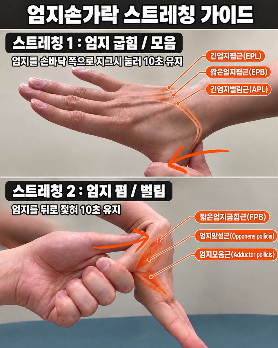 Docter_road's tweet photo. 미안하지만 오늘도 내 꼰대질 한번만 하겠네
핸드폰 오래 쓰는 사람들은 엄지 좀 챙기게.

그래서 오늘은 엄지손가락 스트레칭 2개만
알려주고 가겠네.

혹시 라운드숄더거나 등이 굽었다면 원인이 되기도 할 만큼 엄지손가락의 기능은 중요하다네. 기능 강화 운동도 넣어놨으니 할 커피마시다가 할 사람은 하게나 .

저장해두고 따라하면 라운드숄더고 뭐고 일단 시원하니 꼭 해보시게.

1. 엄지 굽힘 / 모음 스트레칭
① 한쪽 손가락을 쫙피고 주먹으로 엄지잡기
② 엄지를 사진 속 방향으로 지긋이 누르기
③ 가볍게 땡기는 느낌이나면 10초 유지

→ 팔을 접었다가 펴면서 하면 더 시원하네

2. 엄지 폄 / 벌림 스트레칭
① 손목을 뒤쪽으로 젖힌 자세 만들기
② 사진 처럼 반댓손으로 엄지를 지긋이 눌러 밀어주기 (팔을 교차해서 잡아야함)
③ 손바닥 쪽이 당기는 느낌나면 10초유지

→ 얘도 팔을 접은 상태에서 피면서 해도 되네.

요새 사람들 바쁜데 언제 운동하고 있겠나.
30초만 투자해서 하기 좋은 가성비 스트레칭이네. 댓글 마음 알티 누르다가 생각나면 한번씩 하시게.

길박사는 매일 하란 소리만 하지만 가끔 기억날 때 해도 좋은 것만 가져온다네.