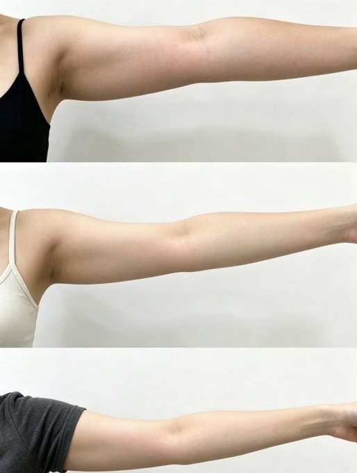 A three-panel comparison showing the progressive slimming of a person's arm, from thicker at the top to noticeably leaner and more toned at the bottom.