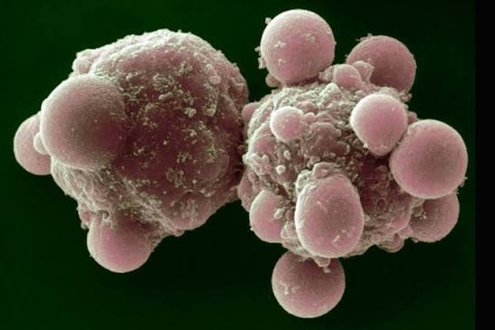 ScienceHaven's tweet photo. Every day, roughly 50–70 billion cells in your body commit programmed suicide. 

It's called apoptosis — controlled demolition that keeps you alive. 

Without it, you'd be a tumor. Your body kills billions of itself daily so the rest of you survives.

#HumanBody #Biology #Cell https://t.co/GYRAWoMjr2