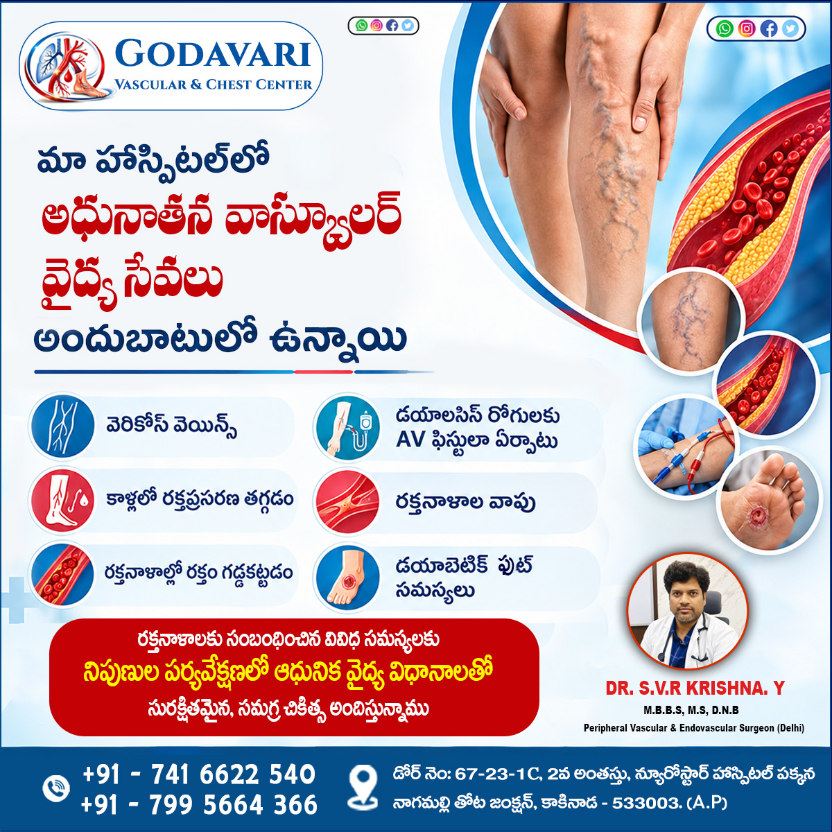 godavarivasculr's tweet photo. 𝐄𝐱𝐩𝐞𝐫𝐭 𝐕𝐚𝐬𝐜𝐮𝐥𝐚𝐫 𝐂𝐚𝐫𝐞 𝐟𝐨𝐫 𝐕𝐚𝐫𝐢𝐜𝐨𝐬𝐞 𝐕𝐞𝐢𝐧𝐬, 𝐁𝐥𝐨𝐨𝐝 𝐂𝐥𝐨𝐭𝐬, 𝐀𝐕 𝐅𝐢𝐬𝐭𝐮𝐥𝐚 & 𝐃𝐢𝐚𝐛𝐞𝐭𝐢𝐜 𝐅𝐨𝐨𝐭.
📞:- 91-741 6622 540 +91-799 5664 366
#GodavariVascularAndChestCenter #VascularCare #VaricoseVeins #drsvrkrishna #kakinada https://t.co/wQ7sxB47Fu