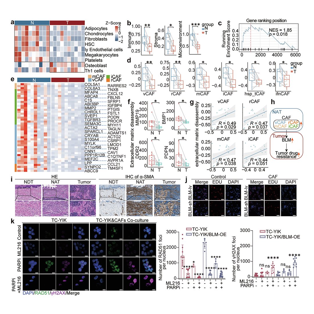 sigtrans_sttt's tweet photo. Can hyperactive #DNArepair be targeted in #Neuroendocrine #CervicalCarcinoma?
#Multiomics reveals HRR activation and a CAF–IL6–E2F1–BLM axis that limits #PARP inhibitor sensitivity, supporting dual PARP–BLM inhibition. @TJU_China
#STTT #OpenAccess: https://t.co/bUzBkO74Ti https://t.co/yUvZHEx4AL