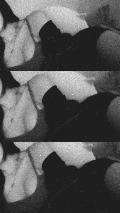 A black and white photo split into three stacked panels showing a person in clothing.