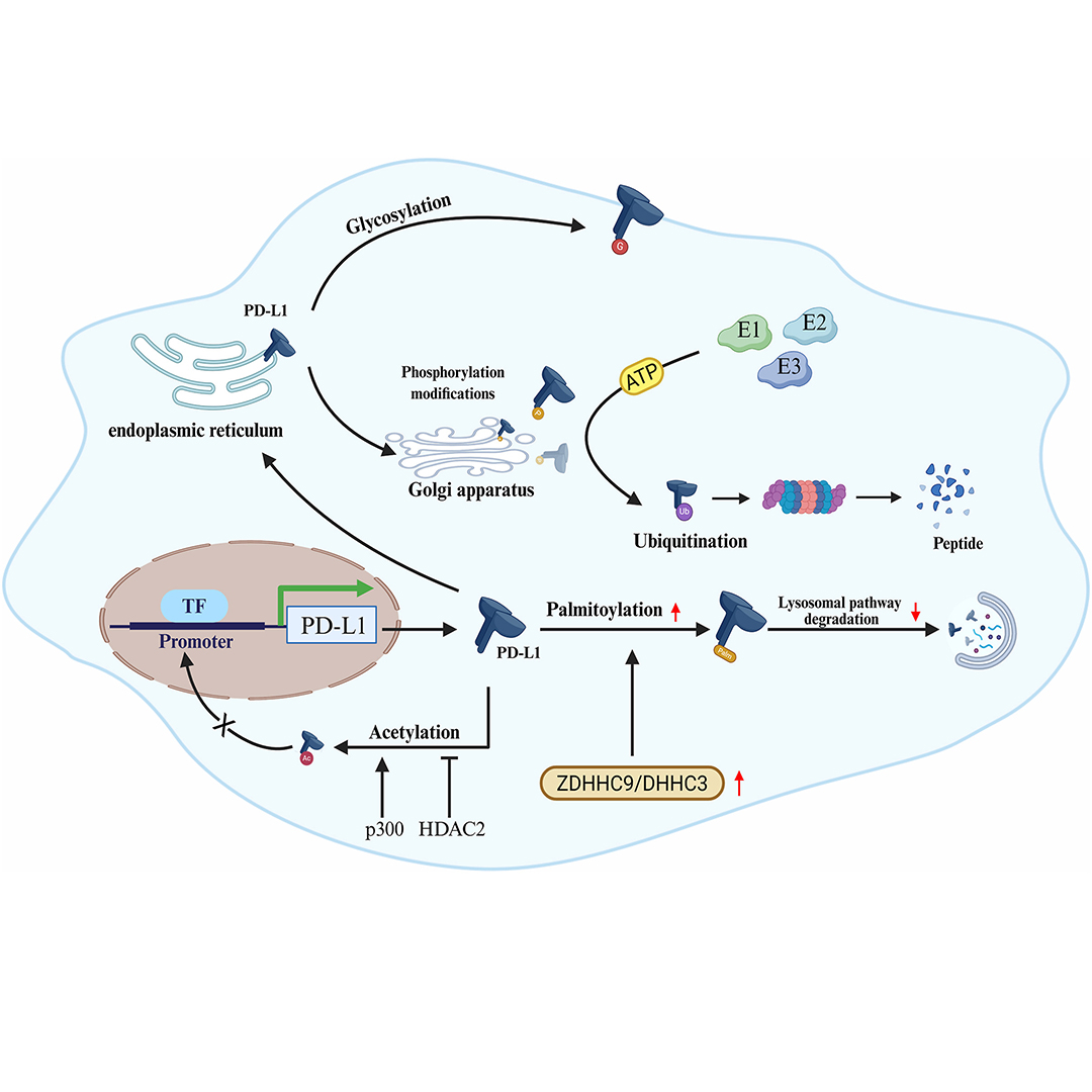 GenesNDiseases's tweet photo. How is #PDL1 controlled beyond transcription?
This review explores its #PostTranslationalModifications and crosstalk, revealing mechanisms of immune escape and potential immunotherapy targets. @x.z.m.u @sjtu1896
#GenesAndDiseases: https://t.co/yGB4h7Qkx3 https://t.co/YPByBzoAp4