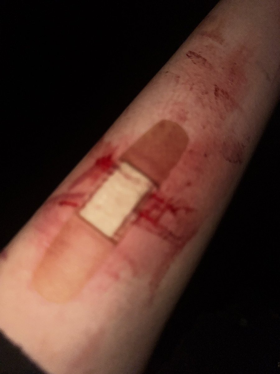 sinkingteadregs's tweet photo. Actin’ like it’s gonna do anything. Halloween fake blood makeup https://t.co/gS7WAXtrqz