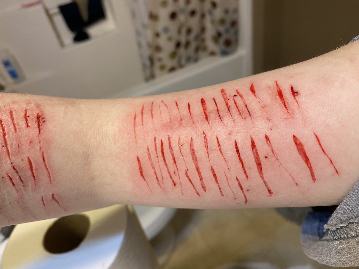 clowncavity's tweet photo. all fake sfx halloween makeup #shedtwt https://t.co/D8cQ3Eswzi