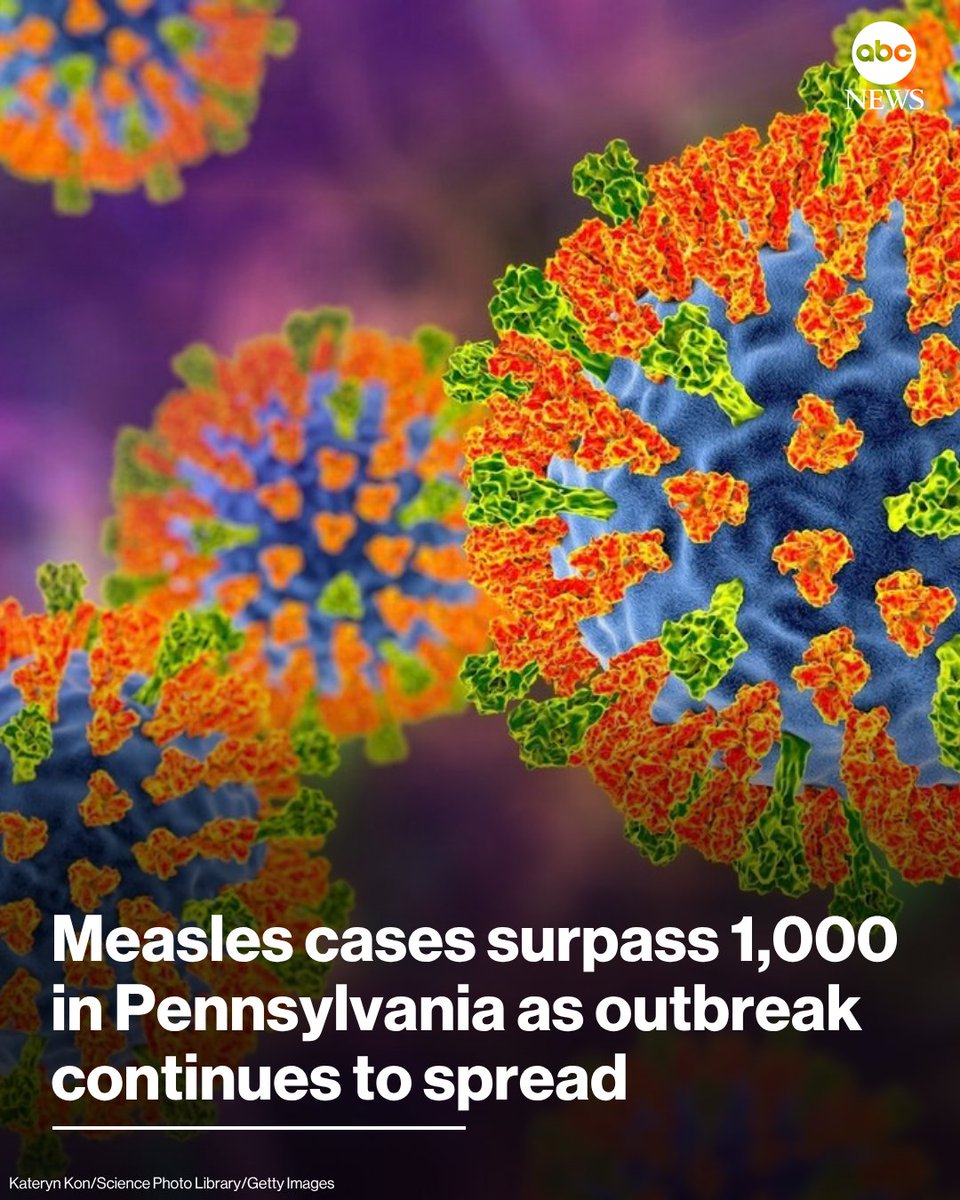 MeaslesOG tweet picture