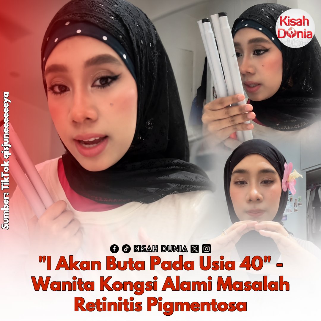kisahdunia_com's tweet photo. Dari sekolah rendah sampai SMK, dia tak nampak apa cikgu tulis dekat papan depan. Kena intai kawan untuk salin nota. Sekarang, bila malam, dia seakan buta😔

Berita Penuh: https://t.co/7bPODOBibL

#retinitispigmentosa #sitinurbalqis #buta #umur #40tahun #KisahDunia https://t.co/VFcGq5pBPE