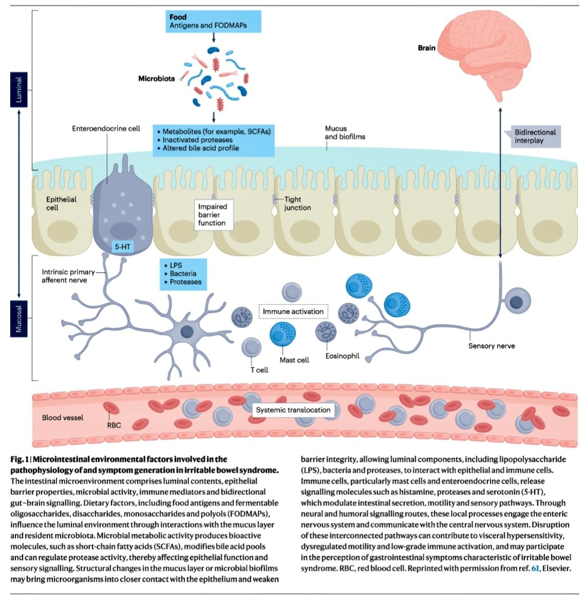 joseramosvivas's tweet photo. 💡🧬 El síndrome del intestino irritable (SII) afecta al 4–11% de la población mundial 🌍 y va mucho más allá de un simple malestar digestivo.

🧠🦠 Nature Reviews Disease Primers revisa cómo la alteración de la comunicación bidireccional intestino-cerebro-microbioma puede contribuir a la hipersensibilidad visceral, la activación inmunitaria de bajo grado 🔬🔥 y otros mecanismos implicados en los síntomas del SII.

🩺📋 El diagnóstico se basa en los criterios de Roma V, junto con la evaluación clínica y pruebas limitadas. El manejo es individualizado y escalonado e incluye educación del paciente 📚, intervenciones dietéticas 🥗, tratamientos farmacológicos 💊 y terapias conductuales dirigidas al eje intestino-cerebro 🧠↔️🦠.

🔭🧪 Estudios longitudinales que integren multiómica 🧬 y neuroimagen 🧠 podrían ayudar a identificar mejor subgrupos biológicos de pacientes y avanzar hacia estrategias más personalizadas 🎯.

🔗👇🏻 https://t.co/3FFNUn30ZD

#SII #SaludDigestiva #Microbioma #EjeIntestinoCerebro #Gastroenterología #Neurogastroenterología #Medicina #Ciencia #Investigación #Microbiota
@SEMicrobiologia